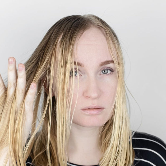 Oily Hair: How To Deal With It Naturally-Hello-Charlie