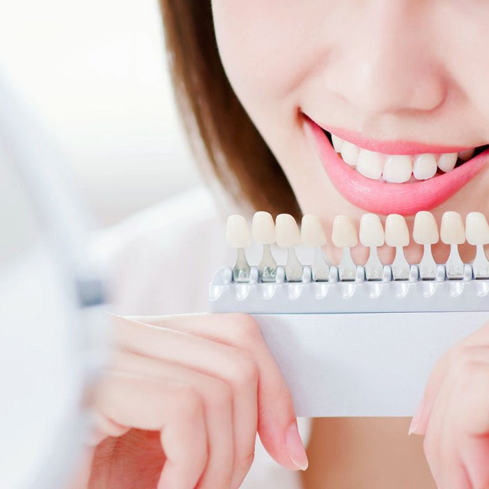 How To Whiten Your Teeth Without Using Toxic Chemicals