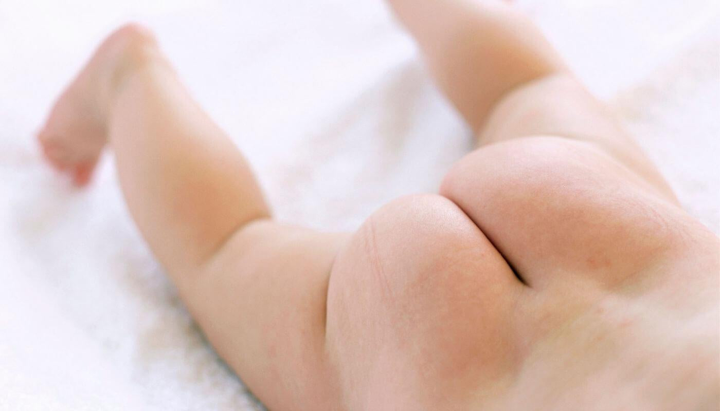 The Complete Beginner's Guide to Nappy Rash-Hello-Charlie